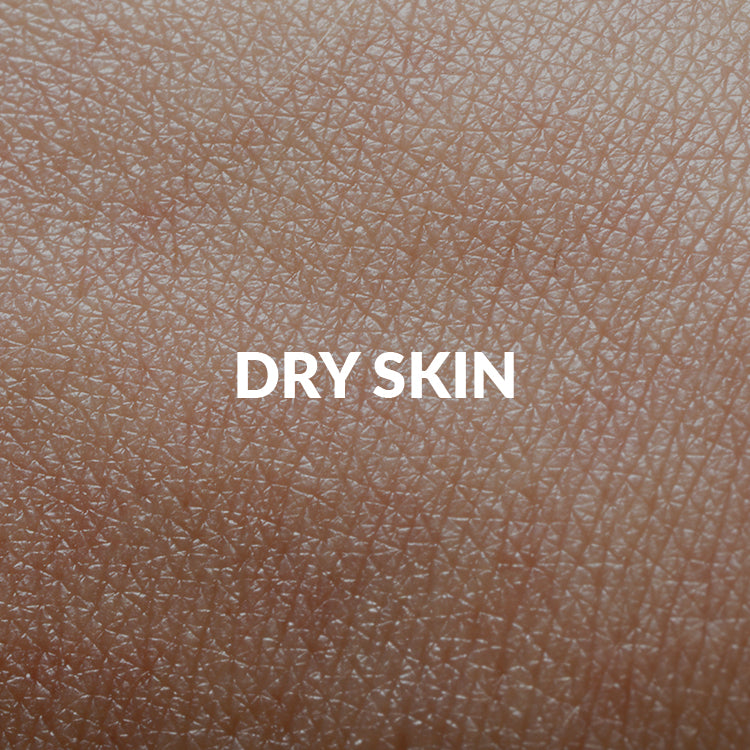 Dryness