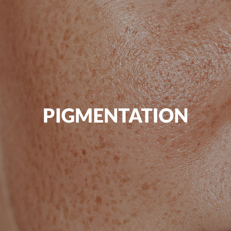 Hyperpigmentation