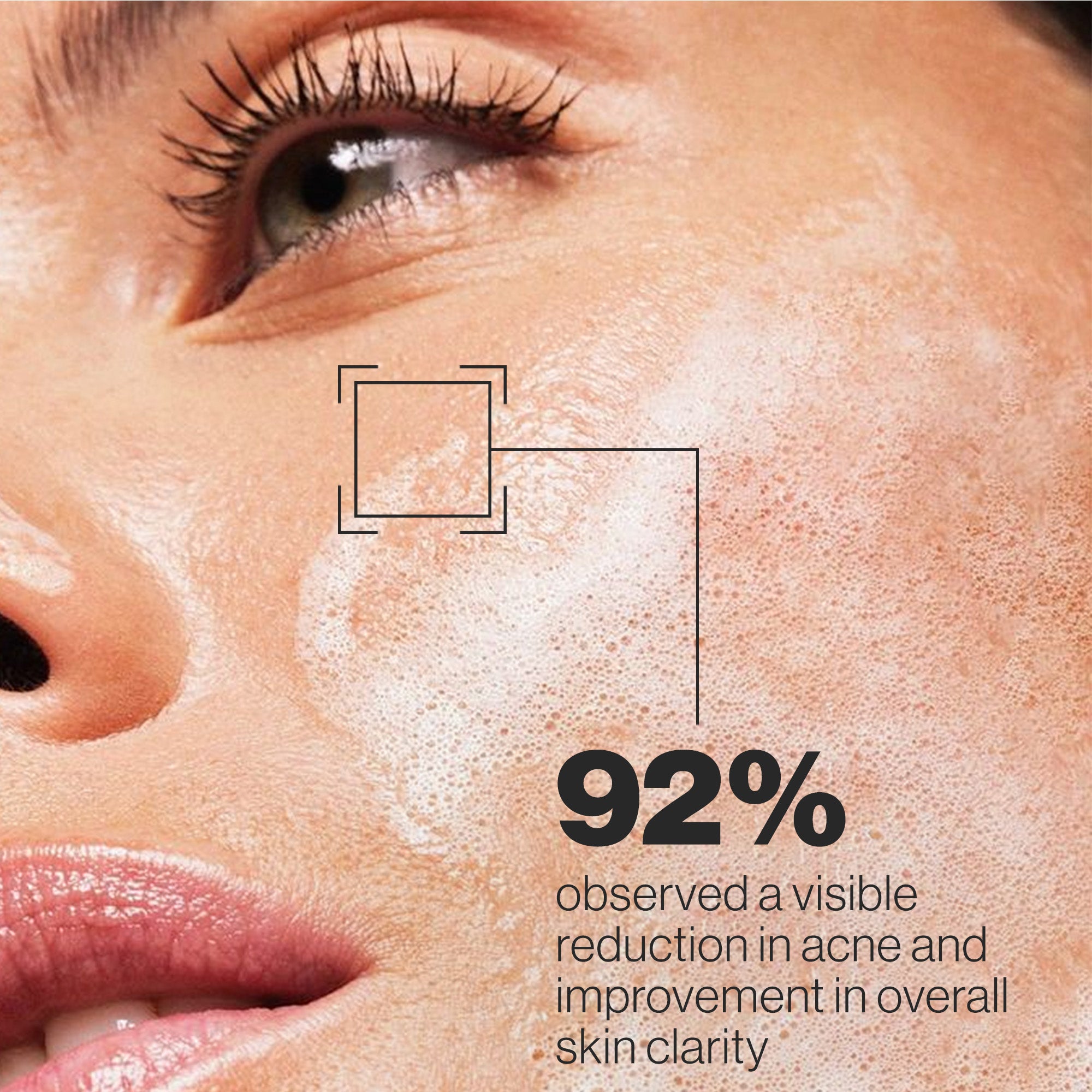 Salicylic Acid Face Cleanser | Oil Control & Acne-Fighting Formul
