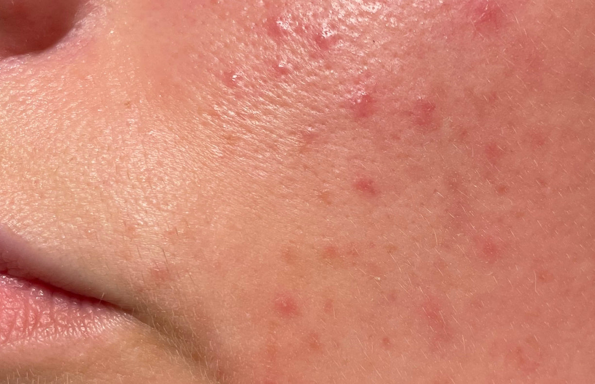 Before Image